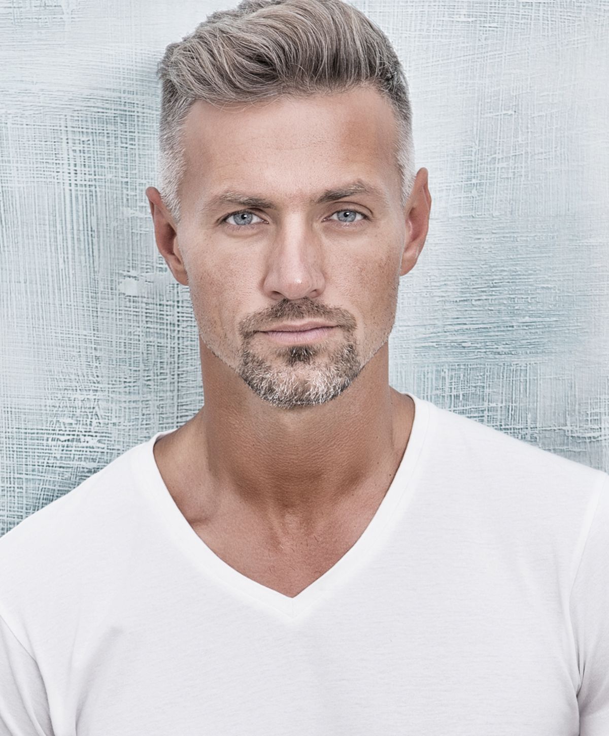hair restoration patient model with stylish hair and beard in white shirt.