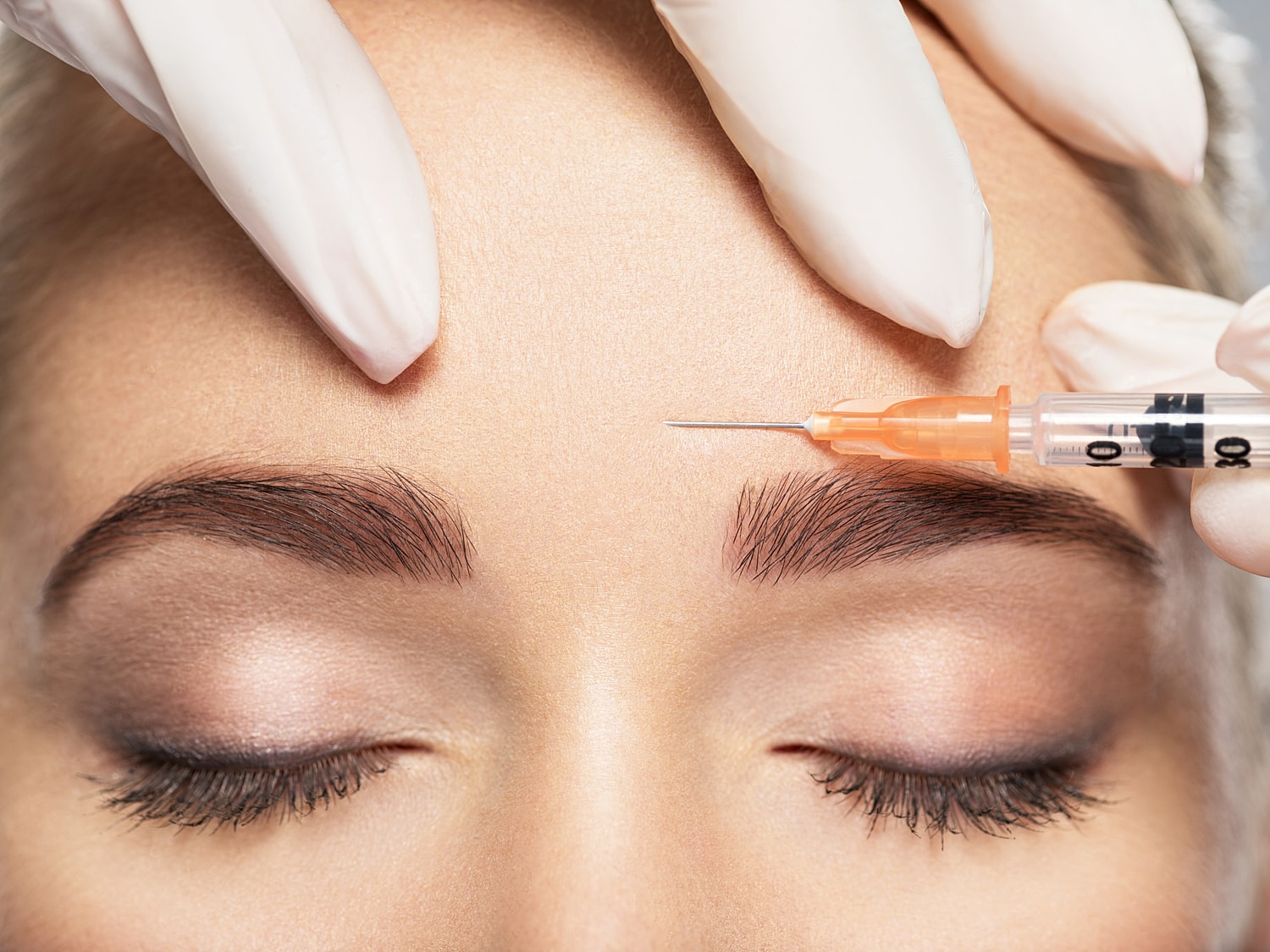 Cosmetic treatment involving injection near eyebrows.