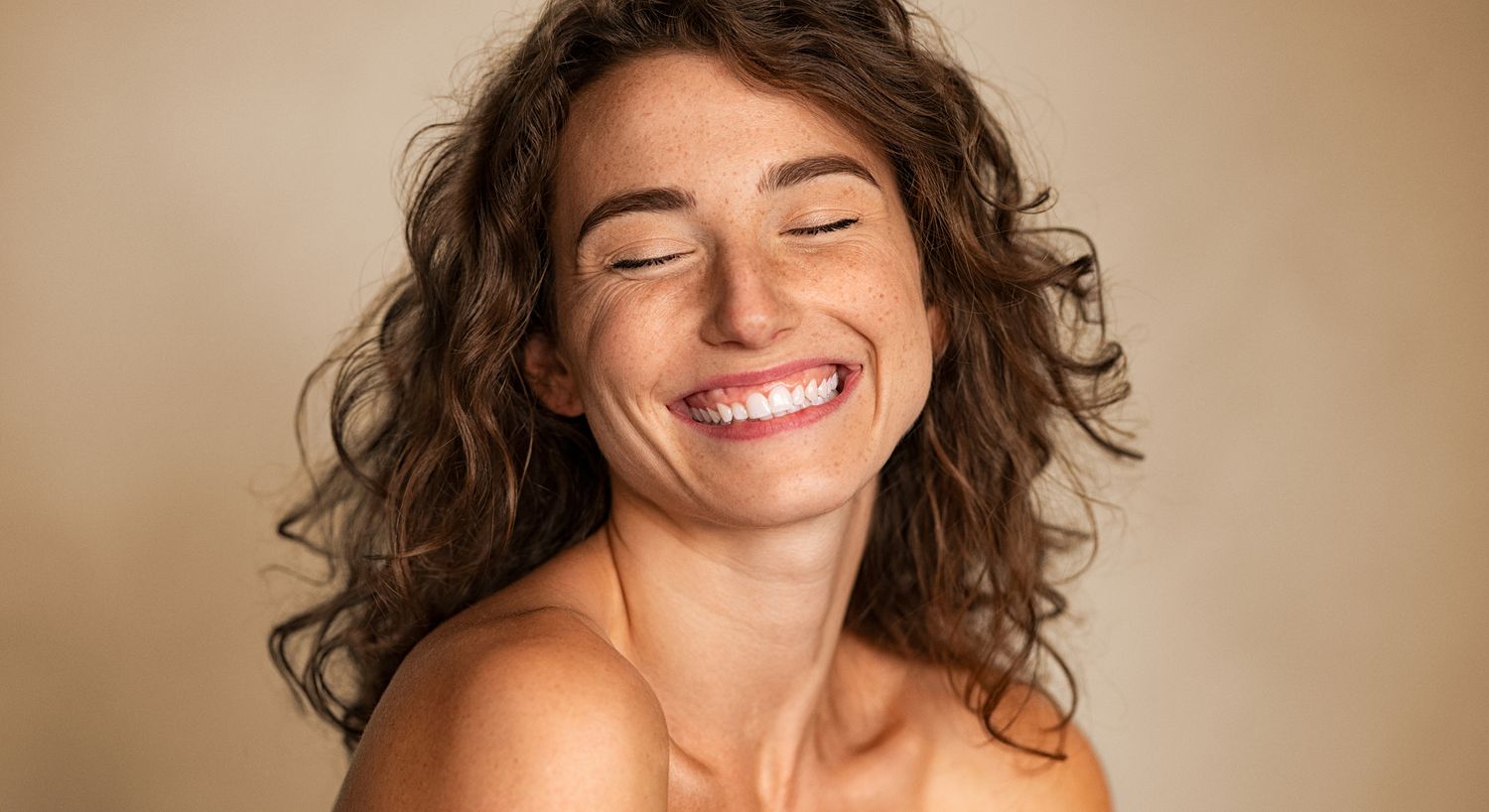 Smiling acne treatment patient model with curly hair and freckles.